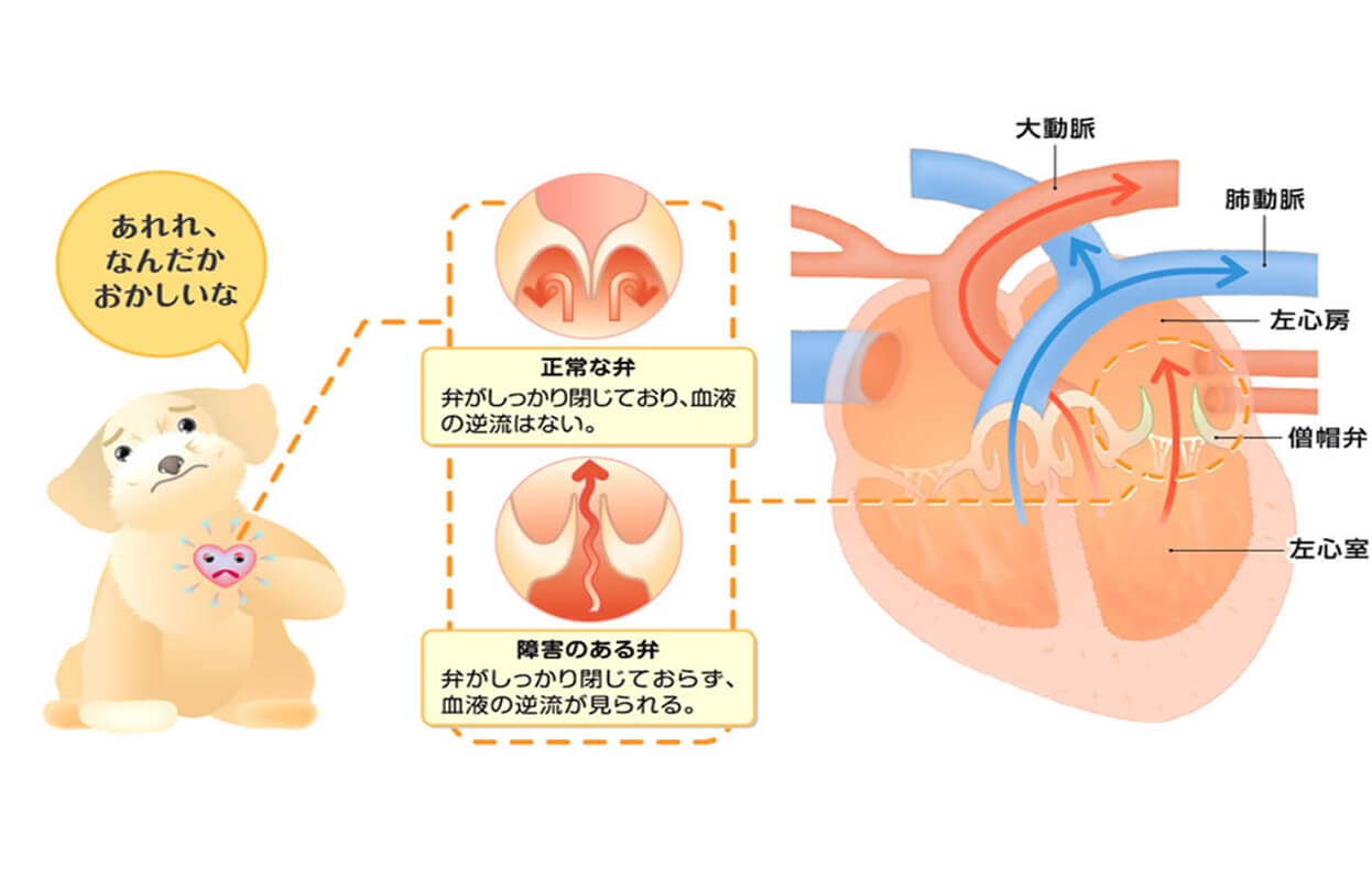 僧帽弁閉鎖不全症